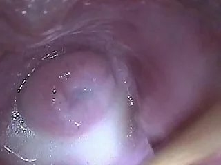 Stick in Baby batter Jizz in Cervix Not far from